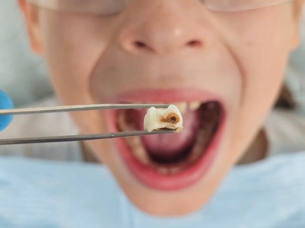 Best Pediatric Emergency Dentist in Pierce, NE
